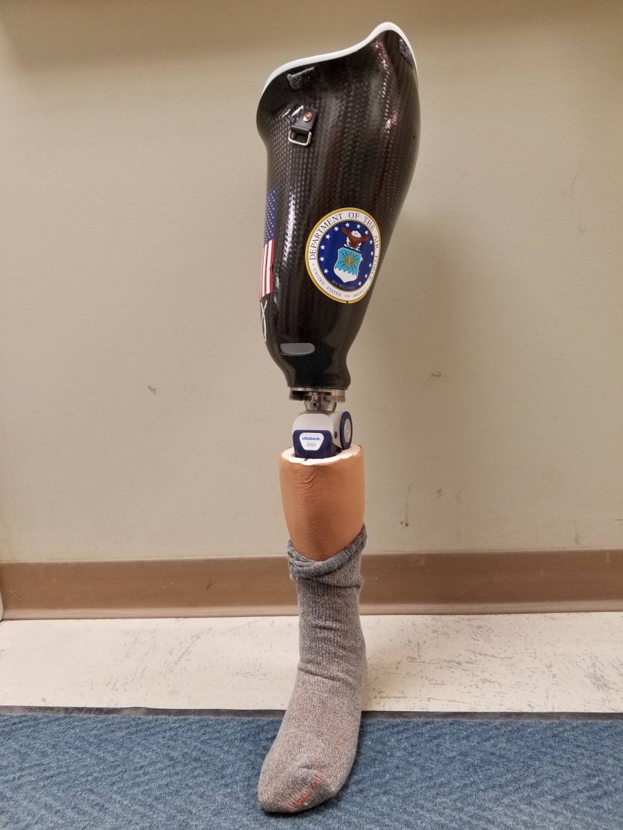 In House Fabrication - Prevail Prosthetics & Orthotics 